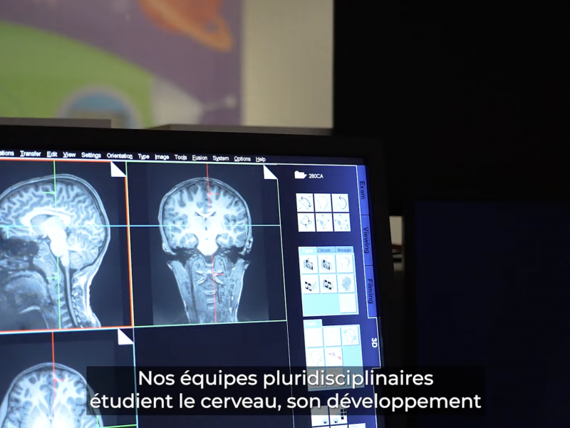 CRNL : une vidéo pour valoriser la recherche en neurosciences